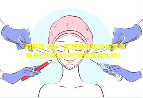 揭阳玻 🌲 尿酸隆鼻价格与案例解析(揭阳最好的整形美容医院)